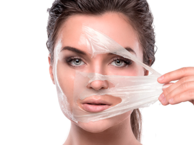 Peeling