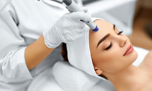 Microneedling