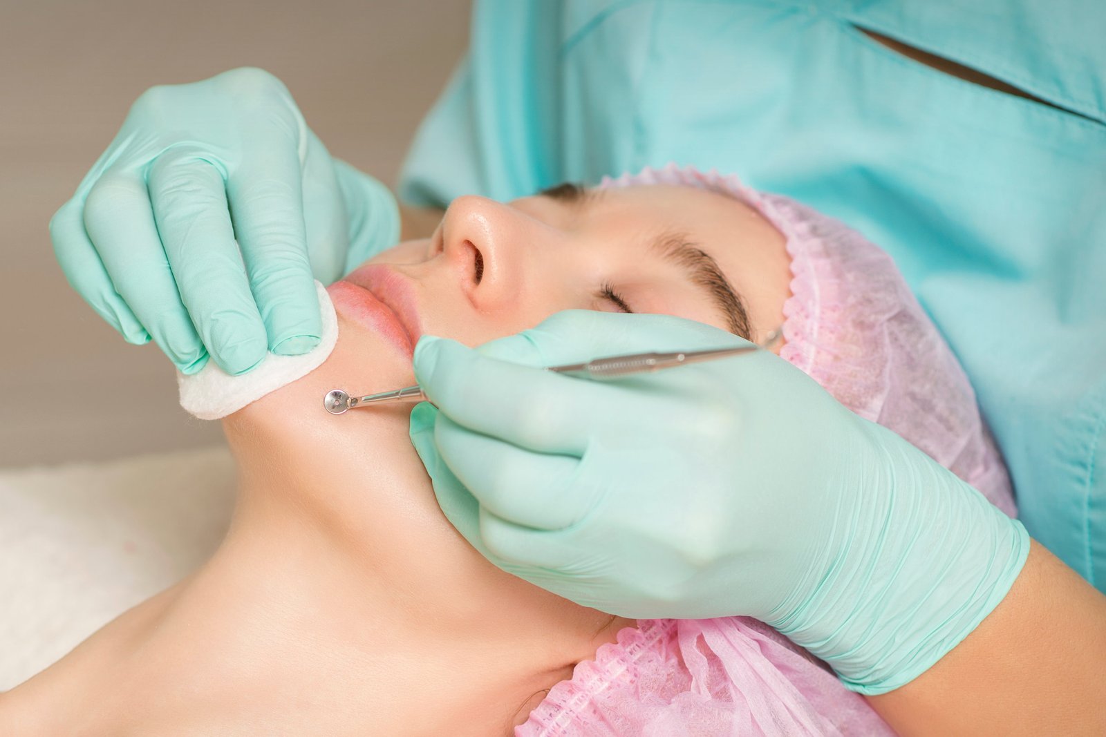 Beautician removing blackhead and acne