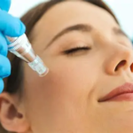 Mesoterapia Facial – Bases, actualizaciones y tendencias 2026