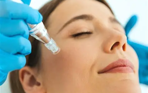 Mesoterapia Facial – Bases, actualizaciones y tendencias 2026